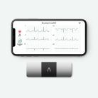 ALIVECOR KardiaMobile 6L 6-elvezetéses EKG (ALC-AC019NUAA)
