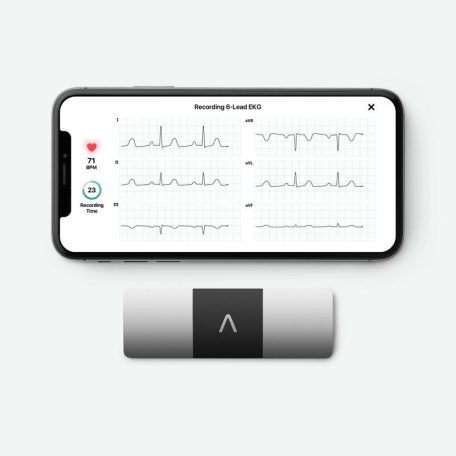 ALIVECOR KardiaMobile 6L 6-elvezetéses EKG (ALC-AC019NUAA)