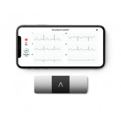 EKG